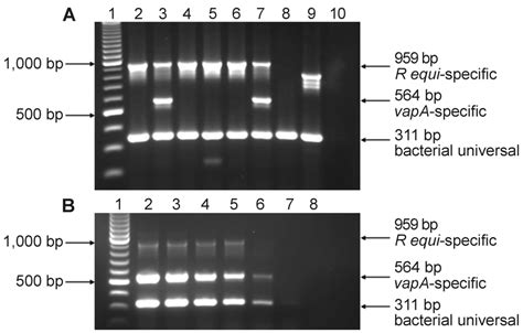 pcr gel electrophoresis results|Polymerase chain reaction (PCR) (article) .
